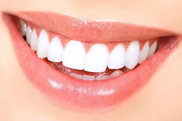 How Long Does Teeth Whitening Take from Aesthetic Smile Center of Pompton Plains in Pequannock Township, NJ